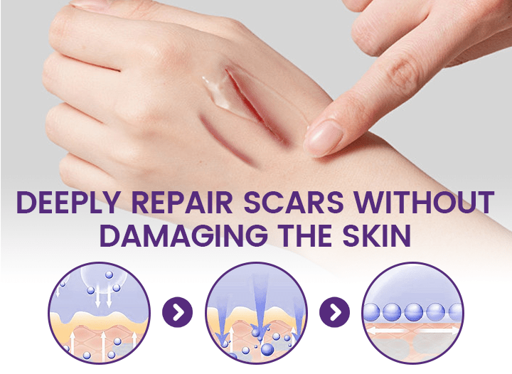 Timilk Regenscar Scar Gel 20g – Advanced Scar Care Gel for Skin - Digital Traders